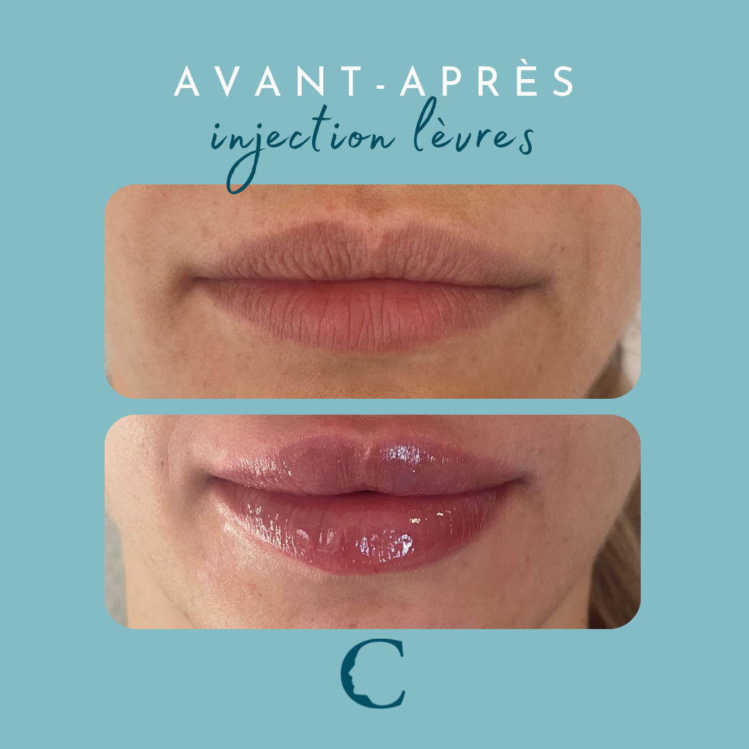 Medecine visage Lyon 