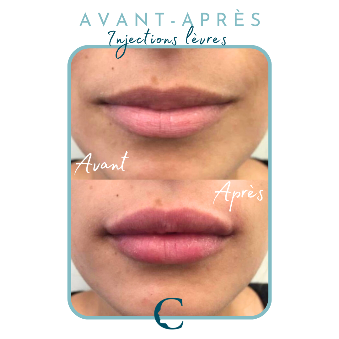 Medecine visage Lyon 