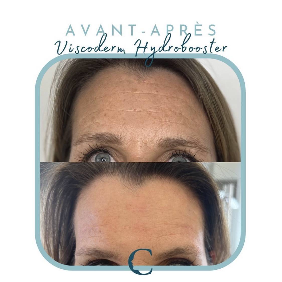 Chirurgie visage Lyon 