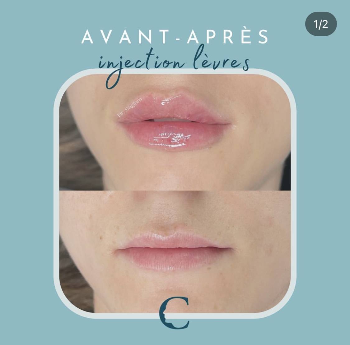 Medecine visage Lyon 