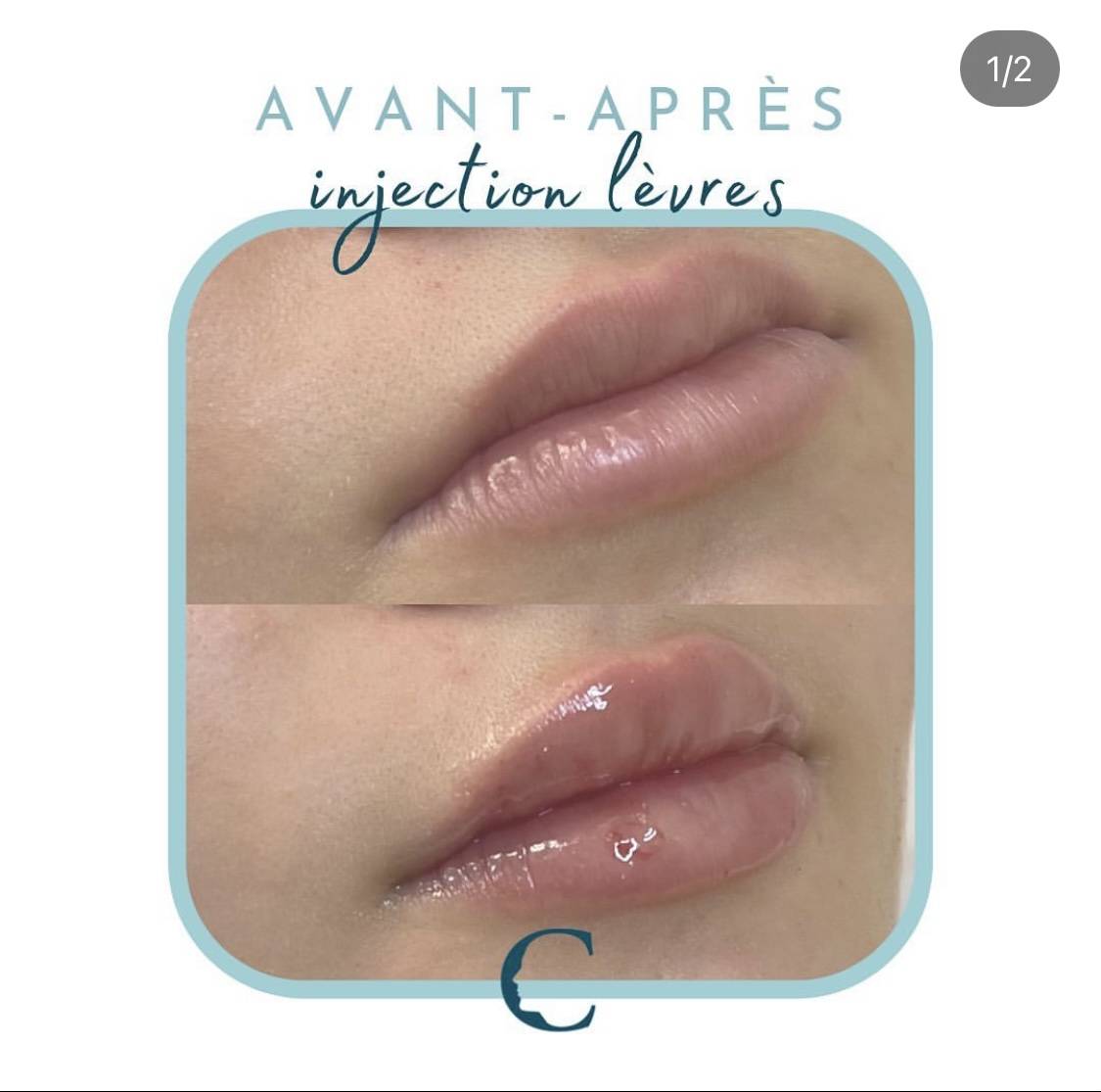 Medecine visage Lyon 