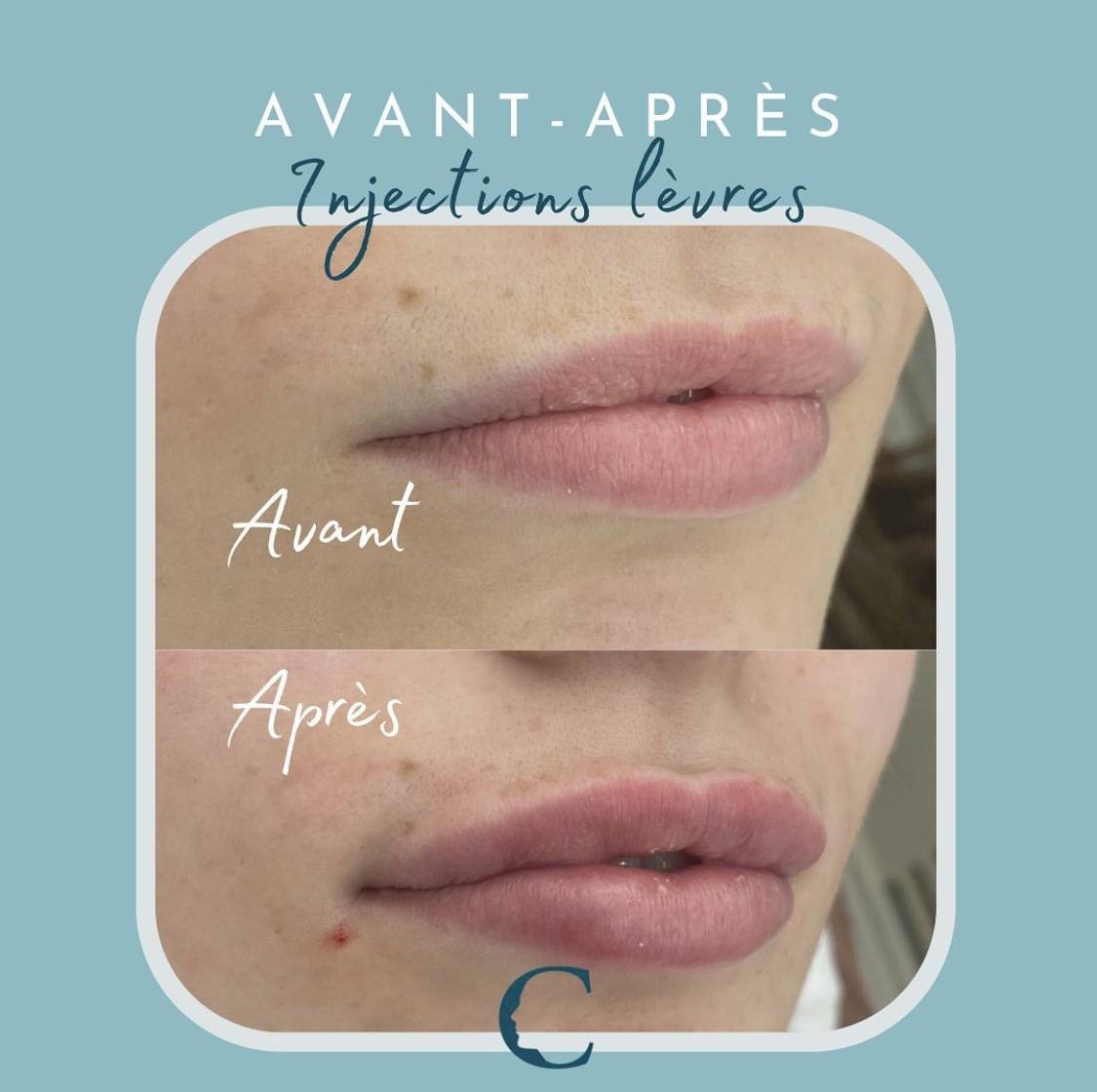 Medecine visage Lyon 