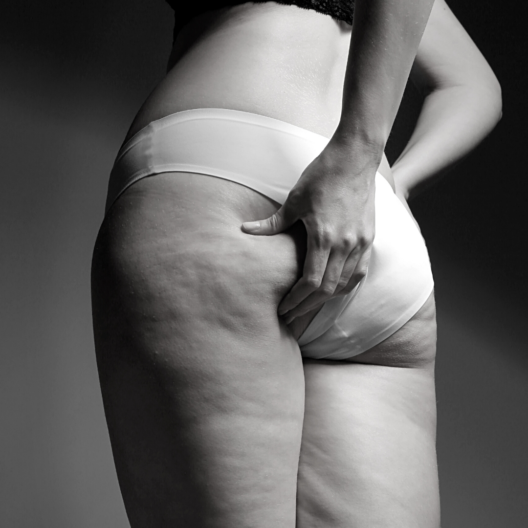 T.W.I.N.E effect, votre solution pour détruire la graisse à Lyon