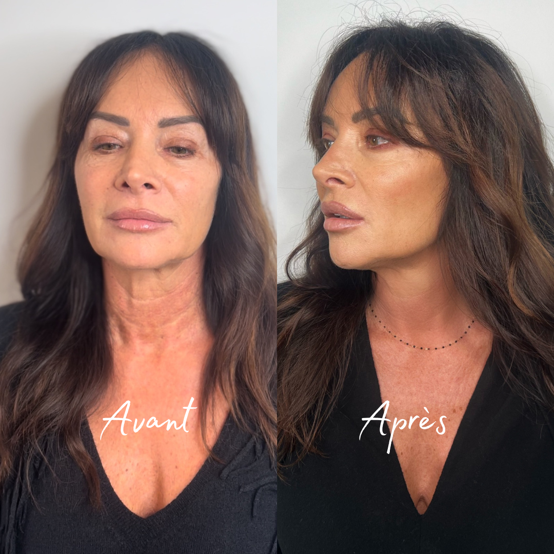 Medecine visage Lyon 