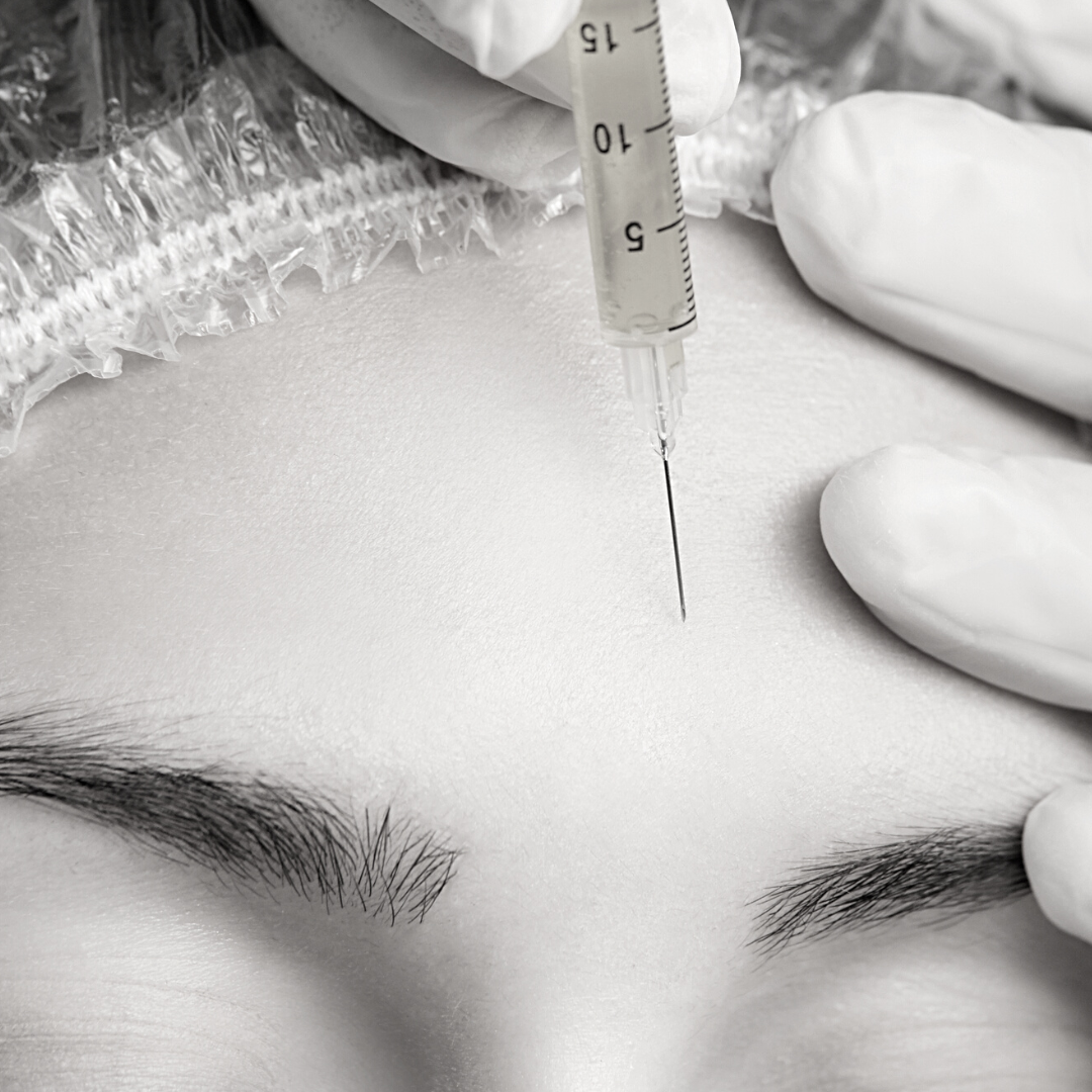 Injections de nanofat à Lyon : votre solution pour conserver une peau jeune