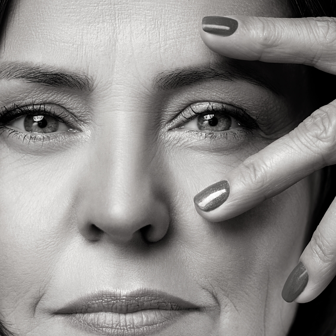 La carbothérapie : votre solution pour le relâchement cutané à Lyon