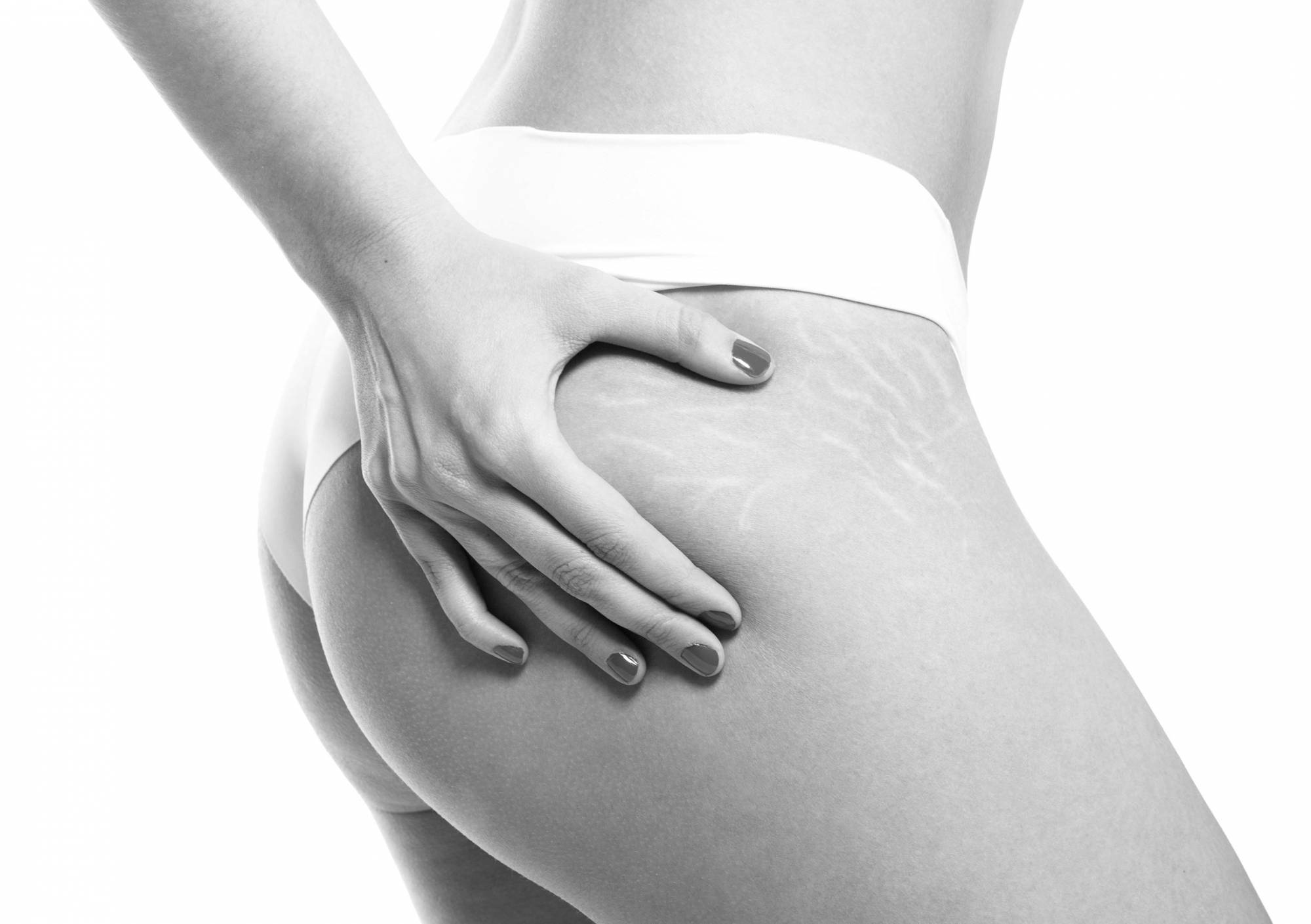 traitement silhouette alser clinique Crillon cellulite cicatrice eliminer graisse à Lyon