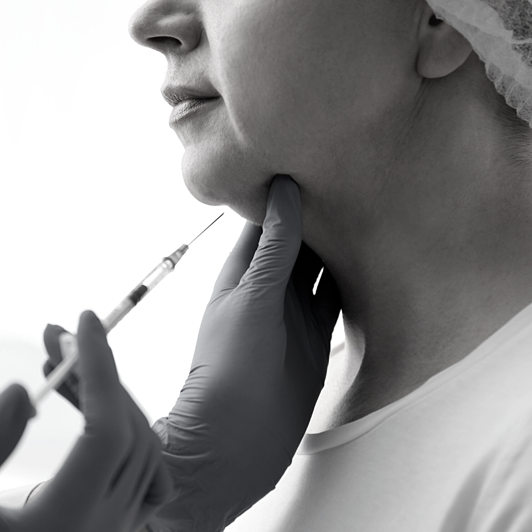 Le nanofat : votre solution pour un coup de jeunesse sans chirurgie à Lyon